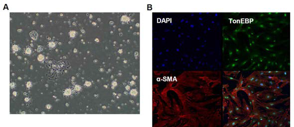 TonEBP+/+ 마우스와 TonEBP+/Δ 마우스 사구체로부터 분리배양한 혈관사이세포 (mesangial cell)