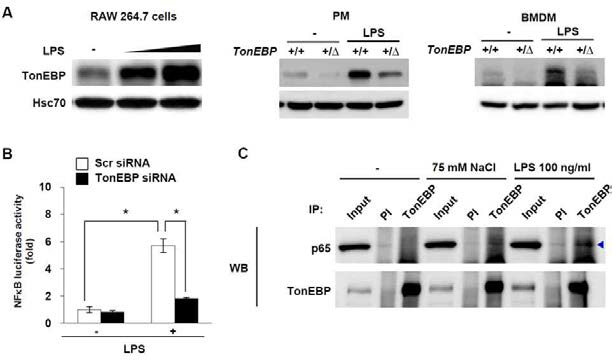 대식세포에서의 LPS에 의한 TonEBP 발현 증가 및 이에 따른 NFκB 전사활성 촉진.