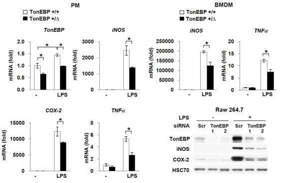 TonEBP에 의한 염증반응의 조절.