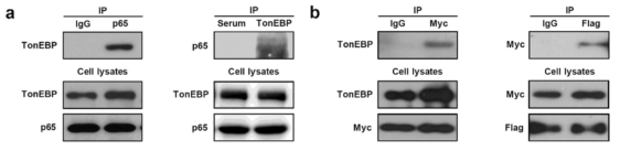 TonEBP interacts with p65.