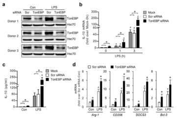 TonEBP reduces the expression of IL-10 in primary human macrophages obtained from 3 donors.