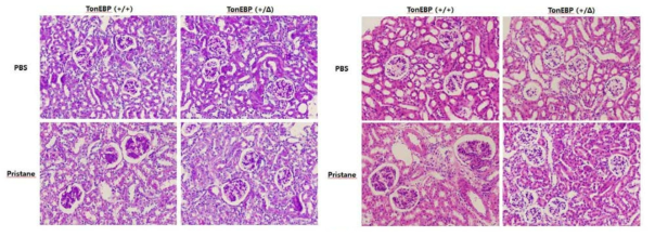 H&E-stained and PAS stained kidney sections