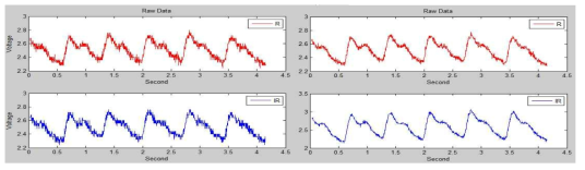 FIR 필터 통과 전/후의 적색/적외선 신호.