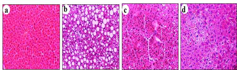 Histology (H&E, Hematoxylin and eosin stain, × 100) of liver paraffin embedded section.