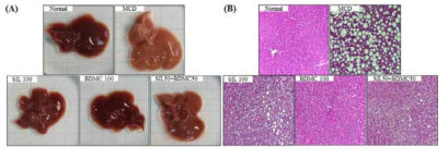 Histological analysis of liver steatosis and liver morphology.