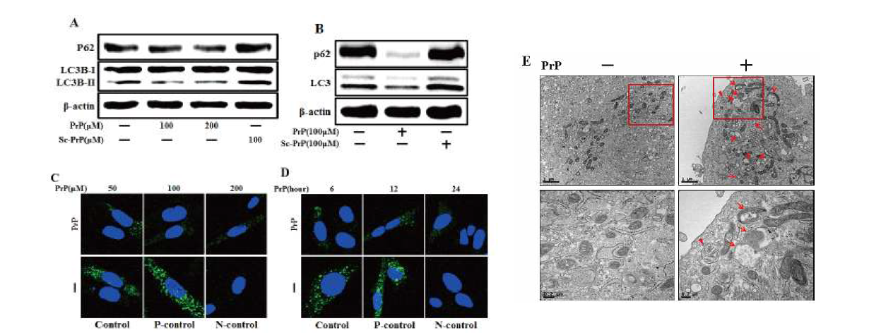 PrP (106-126) treatment induced autophagy flux.