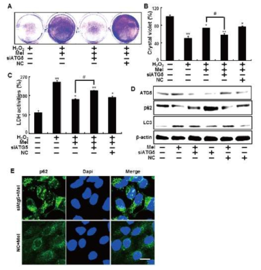 Inhibition of autophagy using ATG5 siRNA to counteract melatonin-related autophagy increases.