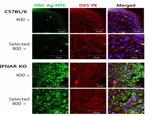 IFN-I signal pathway의 급성 바이러스 감염 후 염증 조직내 NK 세포 infiltration의 confocal microscopy.