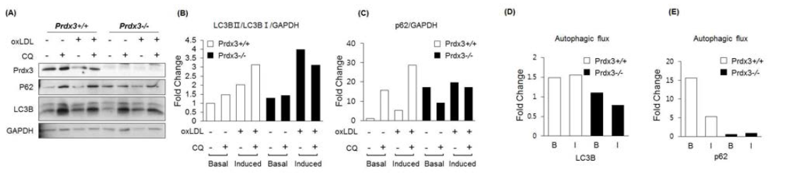 LC3B 와 p62 레벨 분석을 통한 오토파지 흐름(autophagy flux) 정도 확인