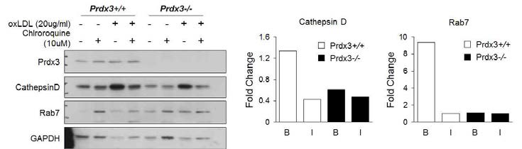 Cathepsin D 와 Rab7 발현 양상 비교를 통한 오토파지 기능적 결함 유무 분석