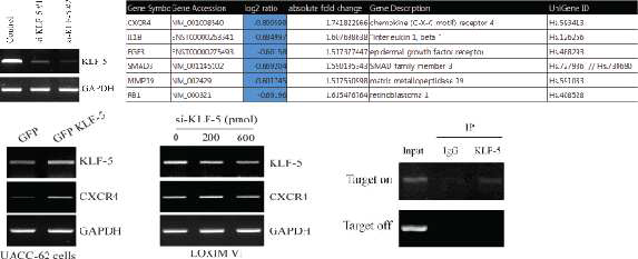 KLF-5의 발현 억제에 따라 CXCR4의발현이 조절됨을 확인한 결과