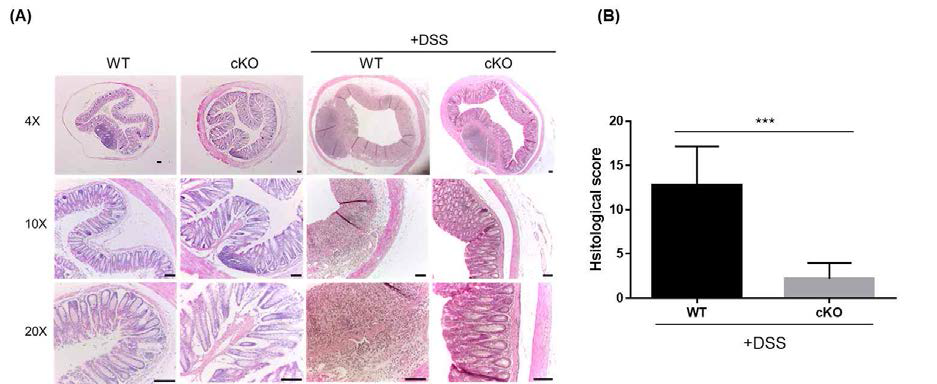Tissue damage of colon by DSS-induced colitis in WT and CISHcKO mice.