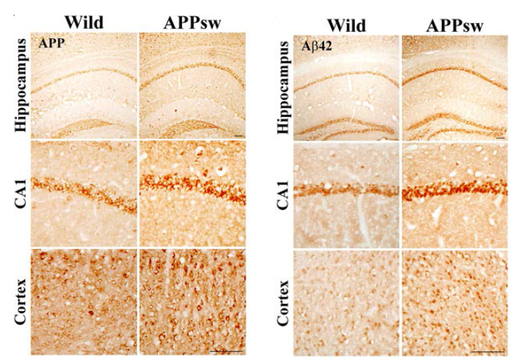 생후 1년된 NSE/APPsw transgenic mice의 신경원세포 특이적 APP/Aβ 발현