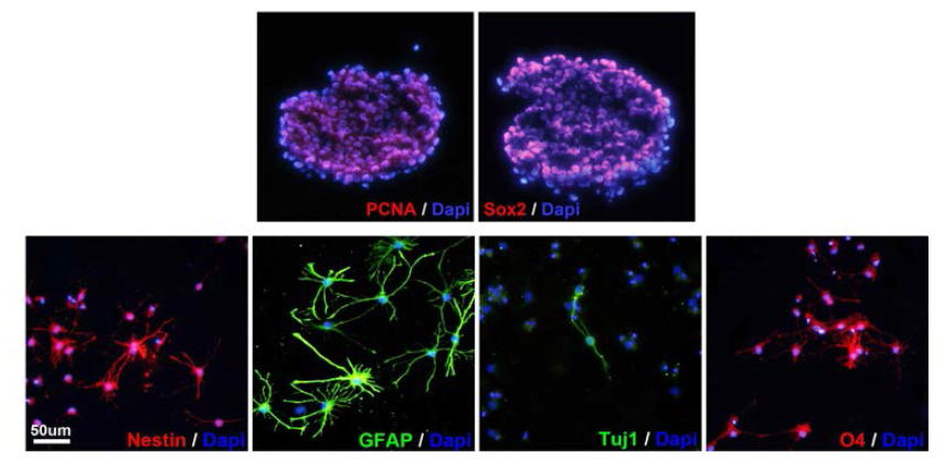 NSE/APPsw transgenic mice 유래 신경전구세포의 증식 및 분화특성
