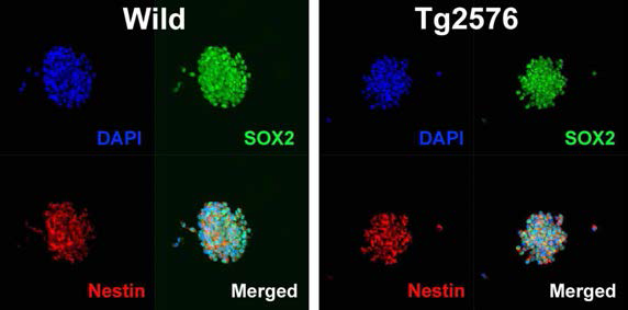 Tg2576 transgenic mice 유래 신경전구세포의 증식 및 분화특성