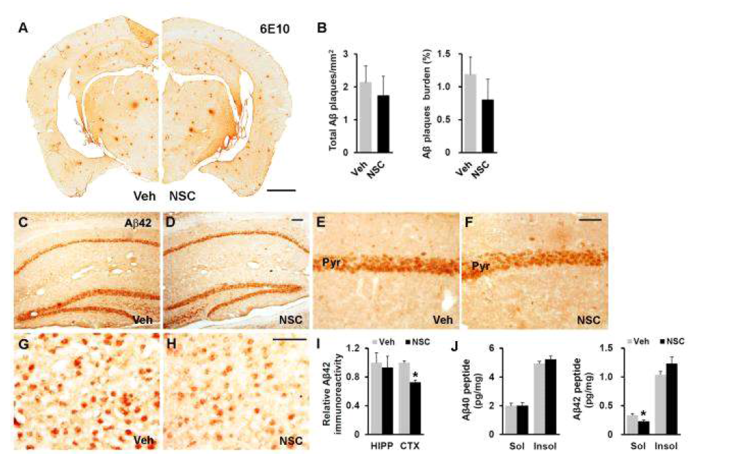 인간 신경전구세포 이식을 통한 알츠하이머병 동물모델의 Aβ의 양 변화