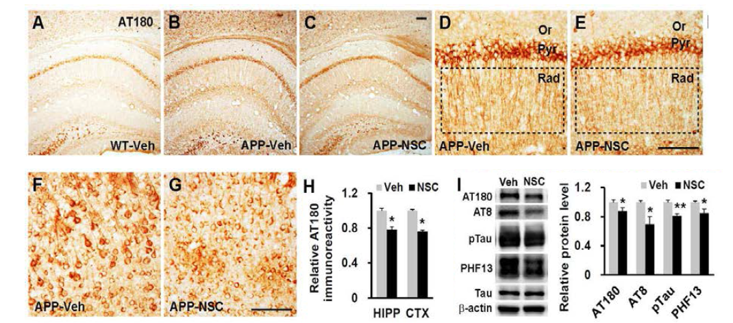 인간 신경전구세포 이식을 통한 알츠하이머병 동물모델의 과인산화 tau의 변화