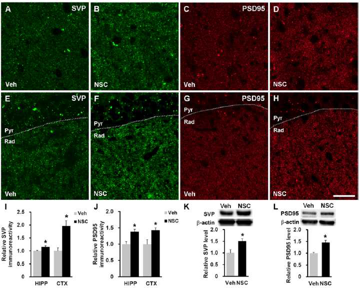 인간 신경전구세포 이식을 통한 알츠하이머병 동물모델의 시냅스 가소성 변화