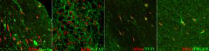 이중모드 나노입자가 도입된 인간 신경전구세포는 생체 내에서 미분화상태를 유지하나, 일부 성상교세포, 신경원세포, 희소돌기아교세포로 분화.