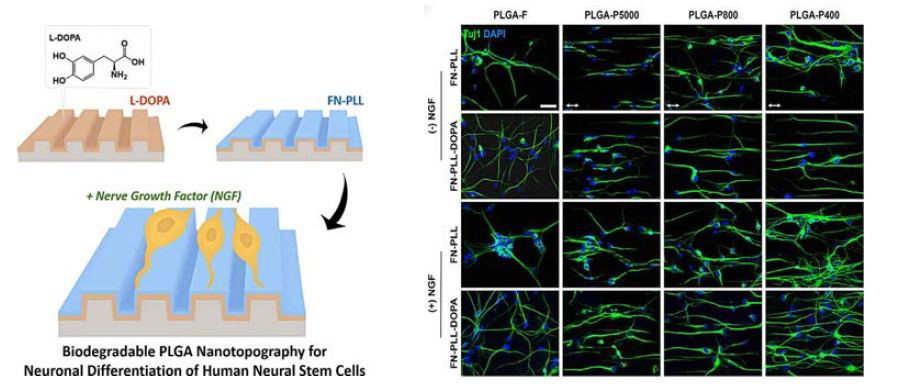 생분해성 폴리머를 이용한 인간 신경전구세포의 분화 및 outgrowth