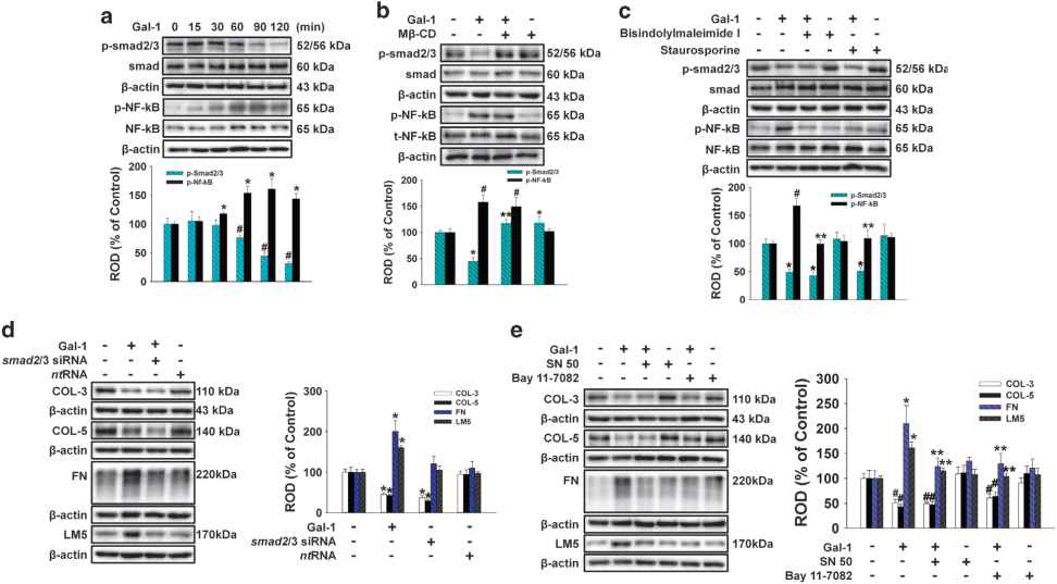 Gal-1에 의한 smad2/3와 NF-κB의 활성은 세포외기질 단백질의 발현을 조절함.