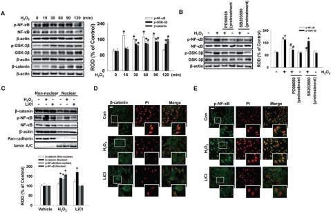 NF-κB와 GSK-3β의 인산화 및 β-catenin 이동에 대한 과산화수소의 효과