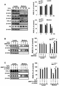 증가된 MMP12가 ECM 단백질 분해에 미치는 영향.
