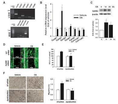 줄기세포의 EphB2 발현 조절에 대한 OA의 효과.