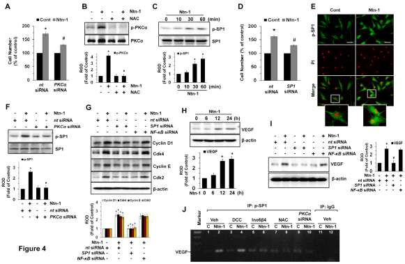 네트린-1이 SP1 활성화 및 VEGF 발현에 미치는 영향.
