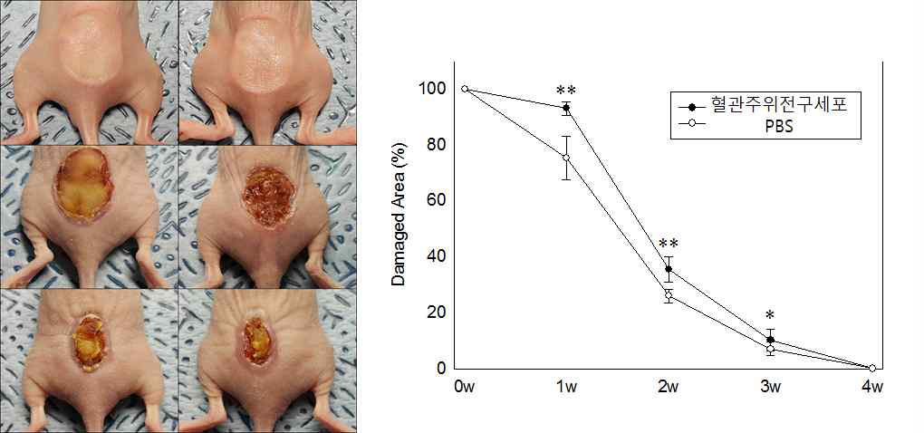 피부화상 모델에서의 인간배아줄기세포유래 혈관주위전구세포의 치료효능