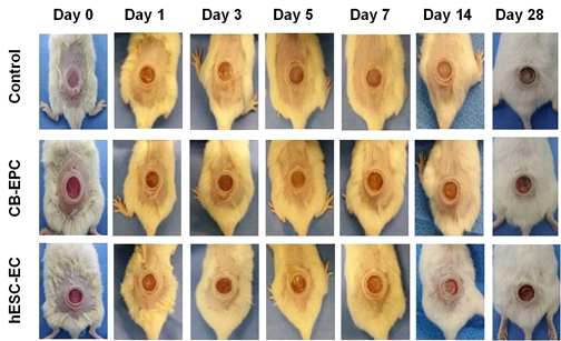 인간화생쥐의 창상회복 진행 사진