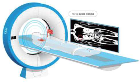 `고정밀 유도전류 치료기기`의 작동 원리