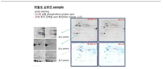 허혈성 말기 심부전 시료의 인산화 단백체 분석 대표 이미지 및 증,감 현상을 보이는 단백질 스팟들의 예시