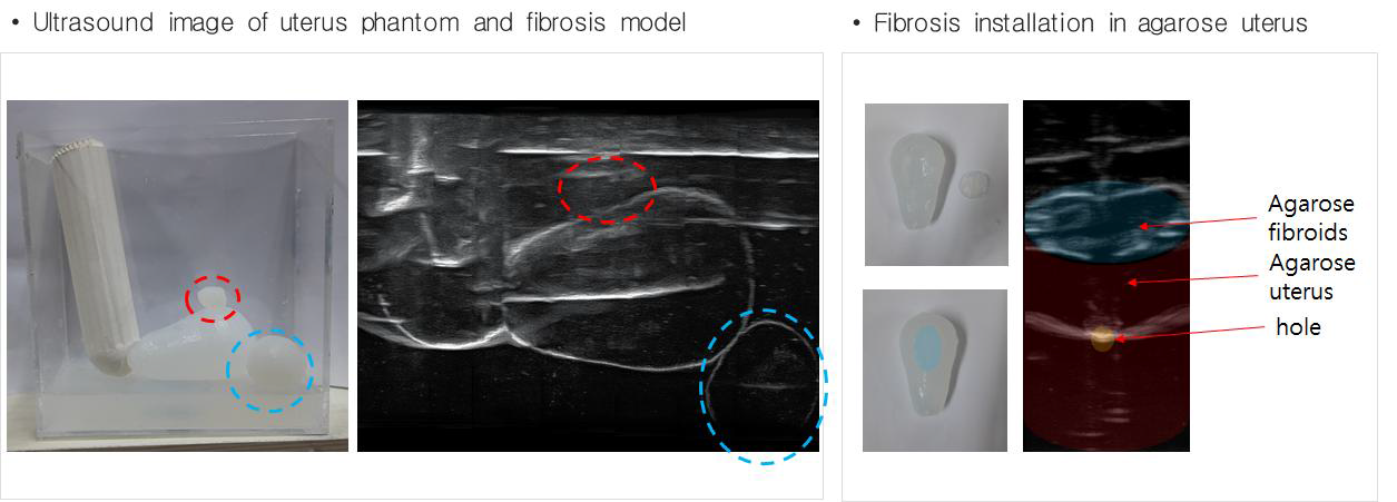 Uterus Phantom과 Fibrosis 모델의 Ultrasoud Image