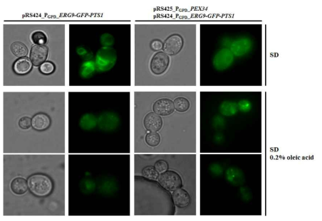 PEX34 과발현과 oleic acid induction에 따른 peroxisome proliferation 정도 및 ERG9-GFP-PTS1의 표적화 정도를 GFP 형광 단백질을 이용해 확인한 결과.
