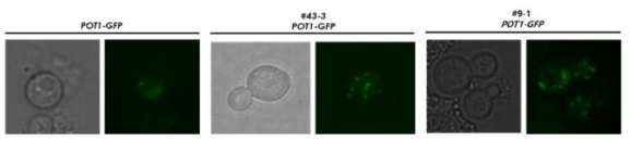 세포 소기관 대사 인자 조절을 통한 peroxisome copy 수 및 size의 조절