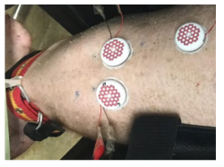(주)아이센스가 동물실험을 위하여 제작한 연속혈당측정 센서 모듈과 블루투스 통신이 내장된 측정기.
