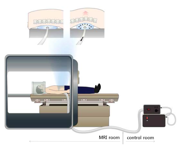 MRI 환경에서 사용 가능한 통증모델