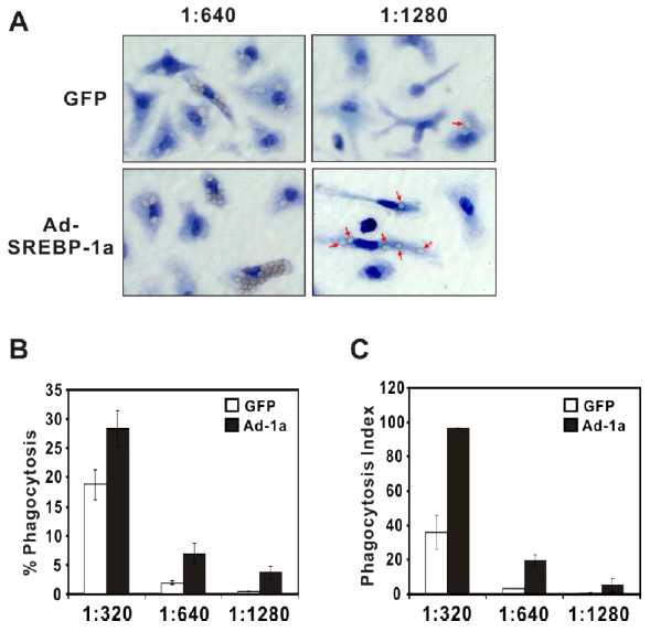 SREBP-1a 유전자 과발현 대식세포와 식세포작용과의 관련성 연구