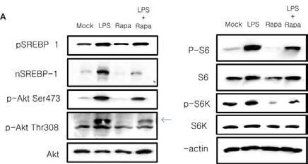 LPS와 Rapamycine에 의한 mTOR 신호 단백질의 변화 양상
