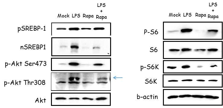 대식세포에서 LPS와 Rapamycin에 의한 mTOR 신호 단백질의 발현양상