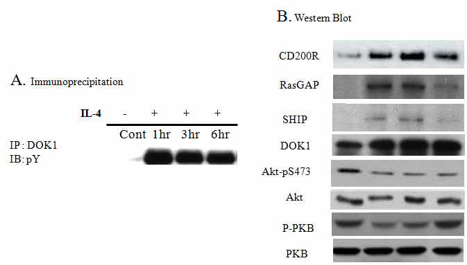 CD200R stimulation induced phosphorylation of Dok1 (A) and increse expression of CD200R, RasGAP and SHIP (B) but pS473, p-PKB are decreased in BV2 cell with IL-4