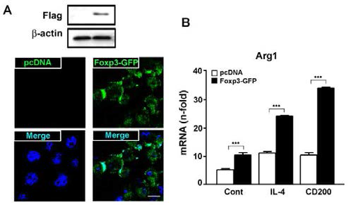 Foxp3 overexpression on M2