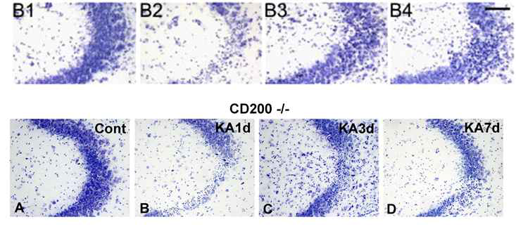 Cresyl violet staining in CD200 knockout mice after KA treatment