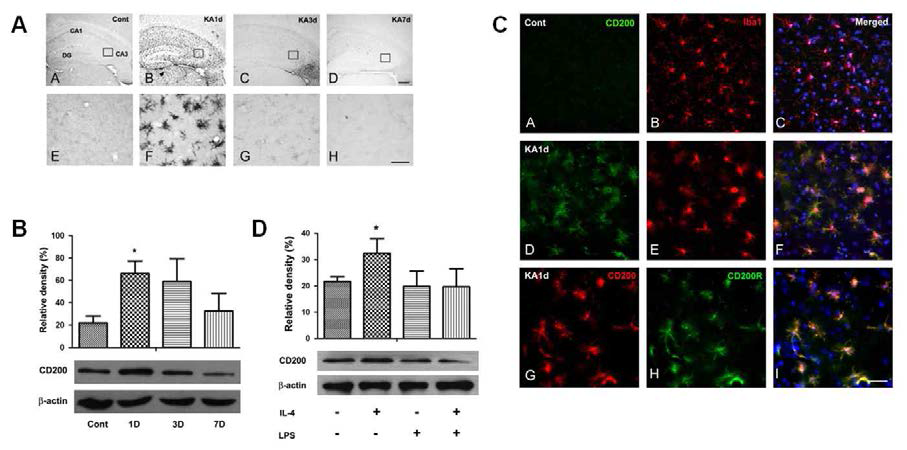 Expression of CD200 in alternative activation of microglia following an excitotoxic lesion in the mouse hippocampus