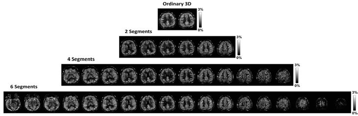 제안된 pCASL-bSSFP 기법과 Segmentation 방법의 접목 결과