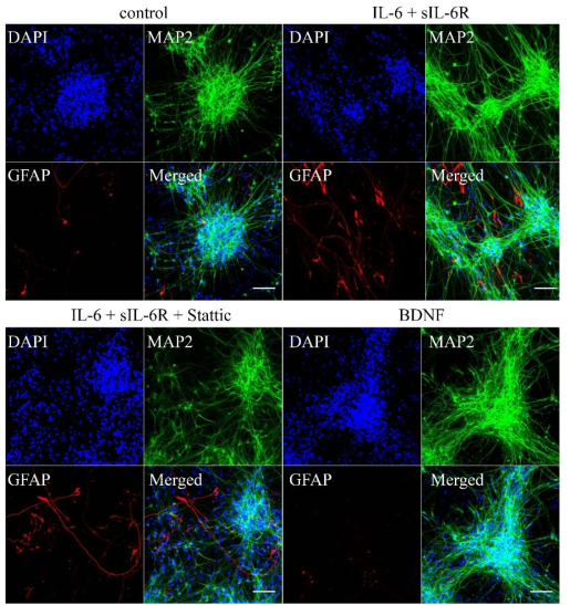 iPSC-derived NSCs are able to differentiate into neuron and astrocyte.