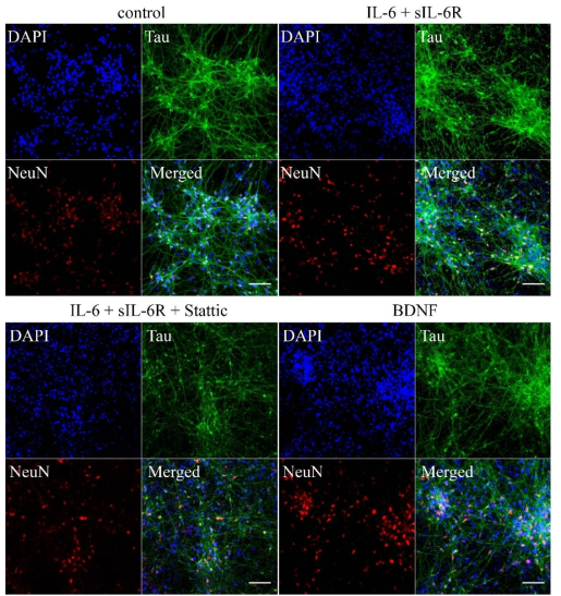 iPSC-derived NSCs are able to differentiate into mature neuron.