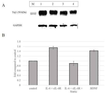 IL-6 and BDNF up-regulate Tuj1 expression.