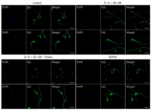 Immunofluorescence staining of sorted neuron showed pure culture with neural morphology.